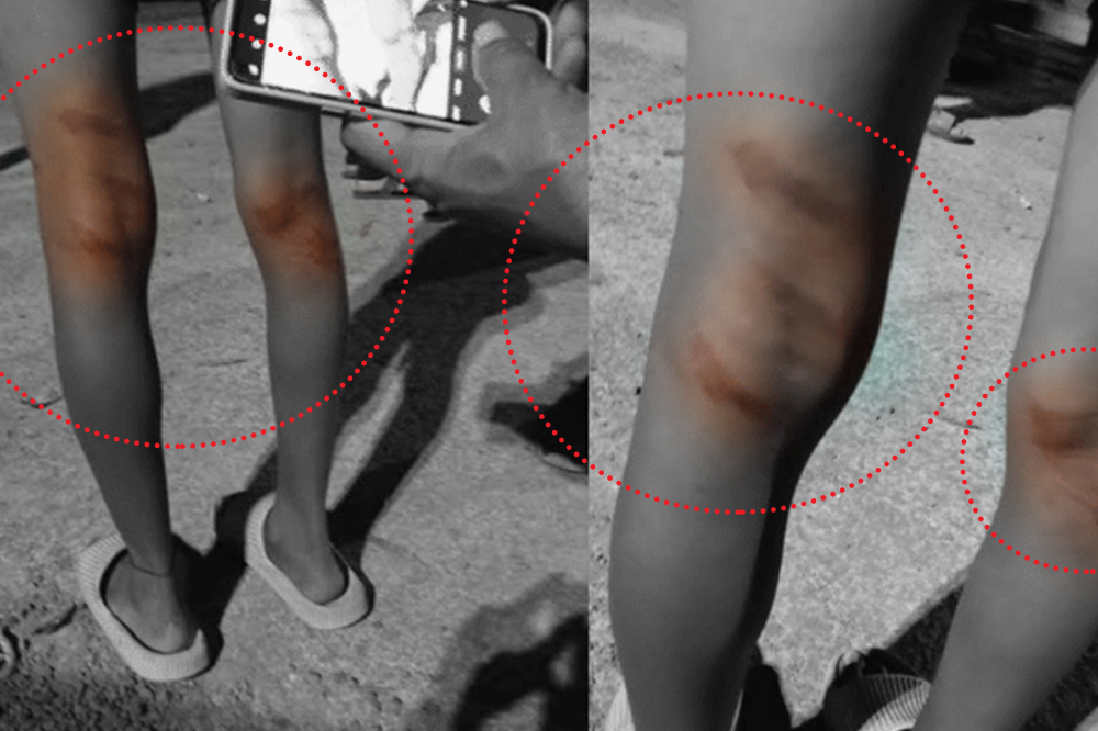 अहमदपूरमध्ये हॉस्टेलमधील ३० हून अधिक विद्यार्थ्यांना बेदम मारहाण; आरोपीविरुद्ध गुन्हा दाखल